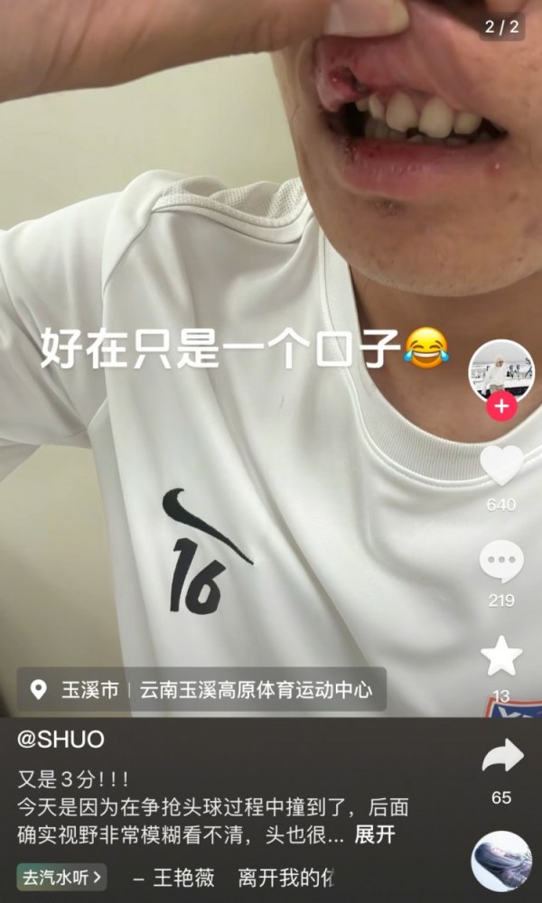 玉昆后场球员晒负伤  照：提前换下因争顶球撞到了 视野模糊看不清&头晕